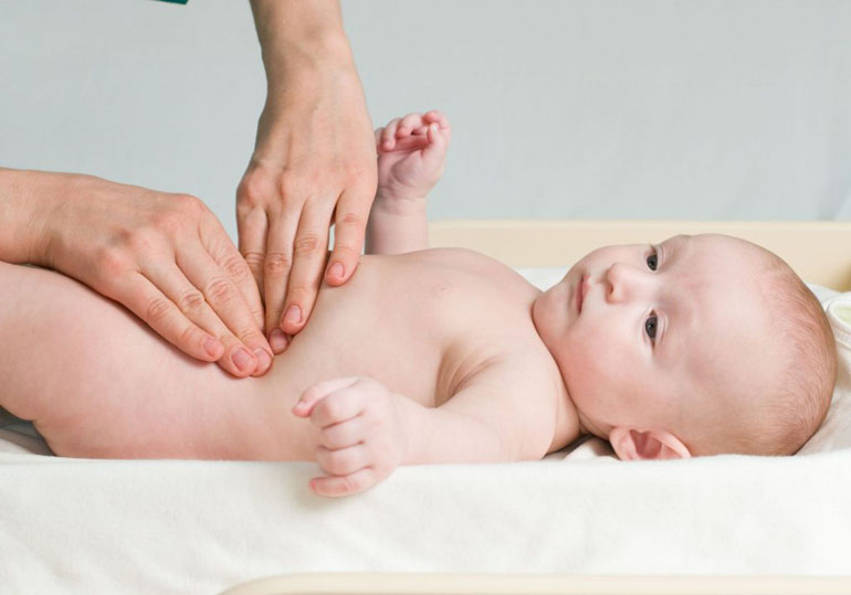 Профилактика пупочной грыжи у младенца и способы лечения.