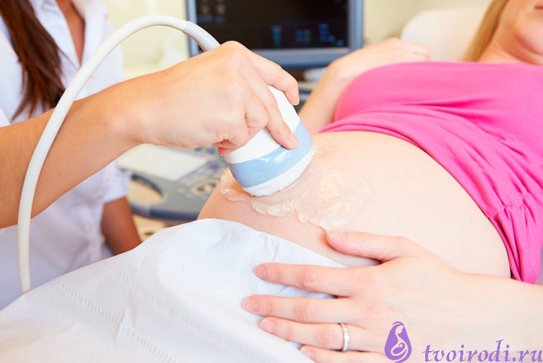 Когда и зачем проводят скрининг при беременности?